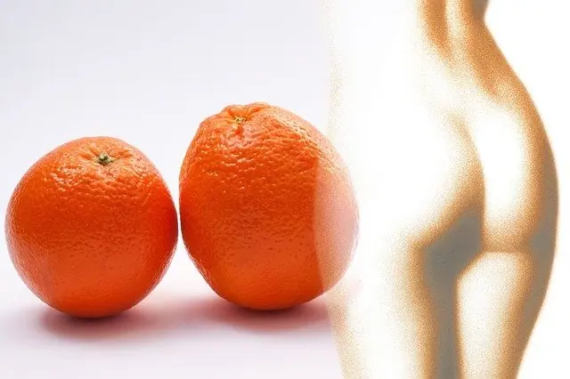 6 dicas de como acabar com a celulite!
