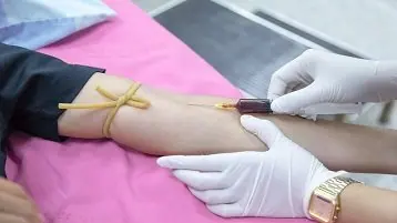 Duração da dieta hipercalórica: quanto tempo fazer?